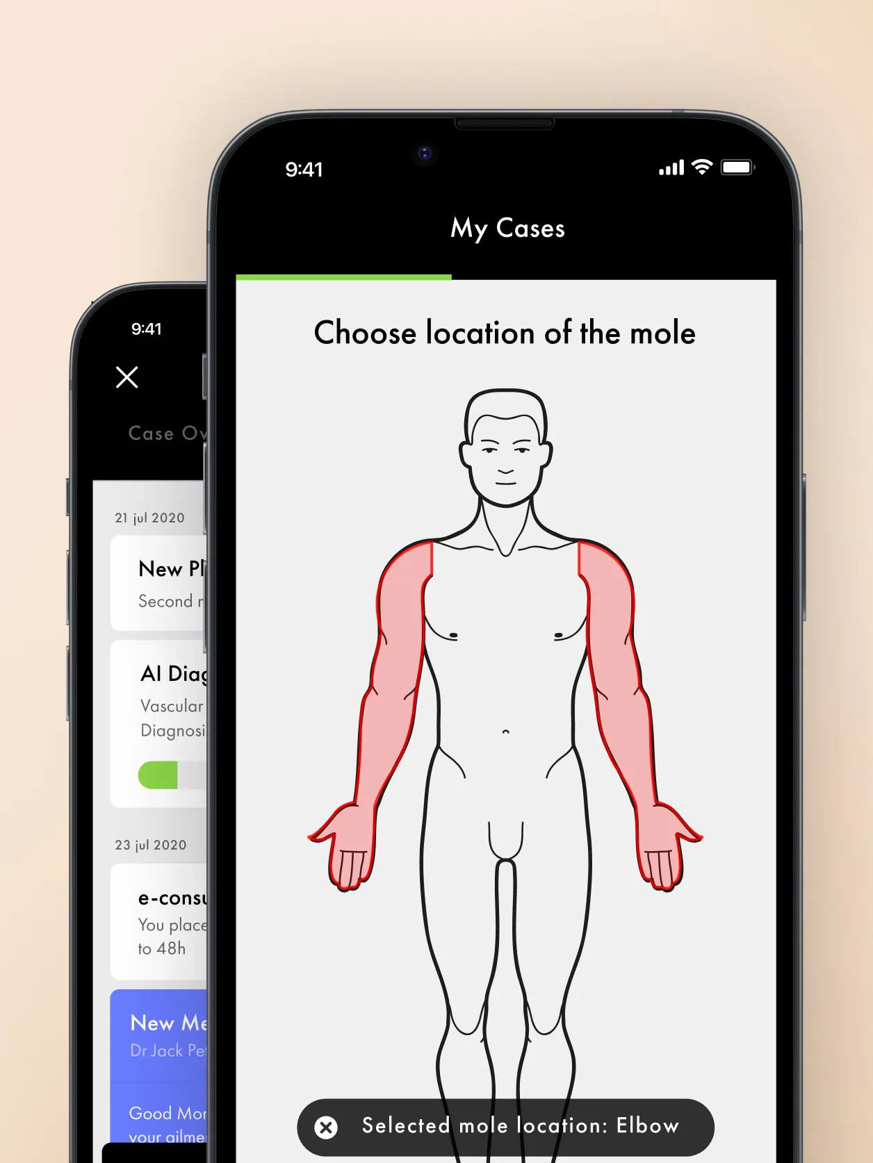 Choosing the location of a mole on a body outline in the app