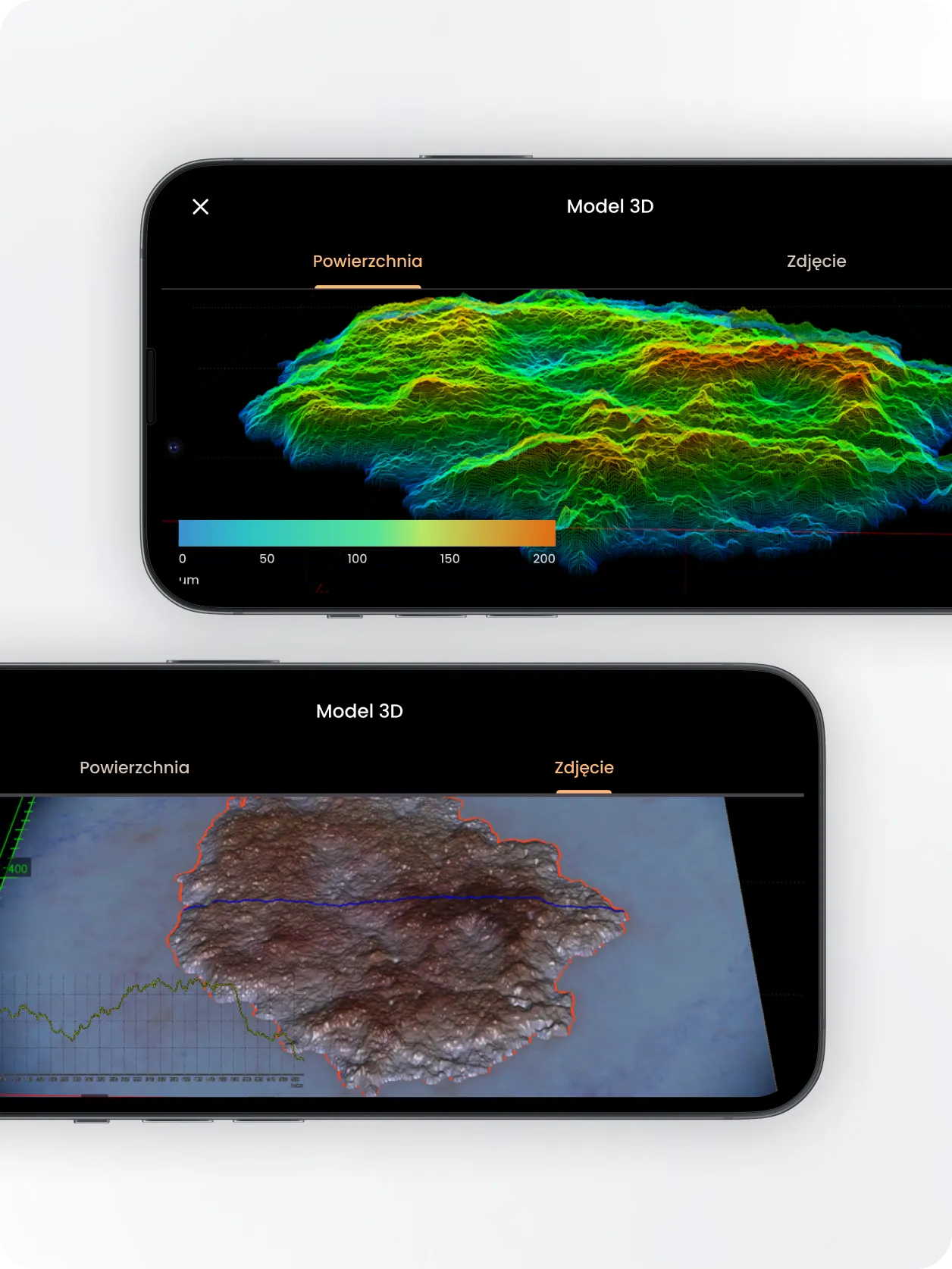 3D model of a mole in the app for dermatologists